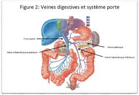 L Ischemie Mesenterique Aigue Fmc Hge