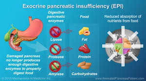 Understanding Nutrition And The Role And Benefits Of Pert Pancreas Health Pancreas Digestive Enzymes