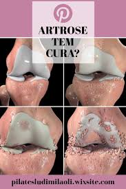 artrose tem cura exercicios para idosos cura dor no joelho