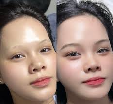 Delicate Touch Esthetics by Mylene