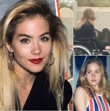 Lyn May And Her Tragic Story That Changed Her Appearance