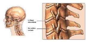 Risulta composto dalla sovrapposizione verticale di 7 vertebre. Chirurgie Spinale Cervicale Par Approche Anterieure Chu De Quebec Universite Laval