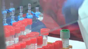 The porcupine health unit provides public health services to the entire cochrane district and hornepayne, in algoma district. Coronavirus Porcupine Health Unit Reports 57 New Covid 19 Cases Friday Ctv News