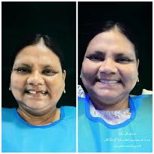 Top Composite Bonding Treatment Doctors in Tinsukia