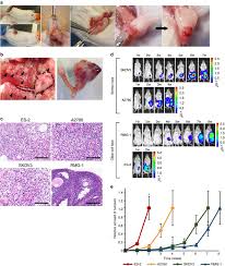 But you do know your own body, so. Malignant Extracellular Vesicles Carrying Mmp1 Mrna Facilitate Peritoneal Dissemination In Ovarian Cancer Nature Communications