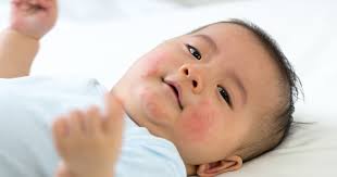 Rashes are common in newborn babies. Baby Rash Around Eyes Chin Neck Back Stomach Treatments