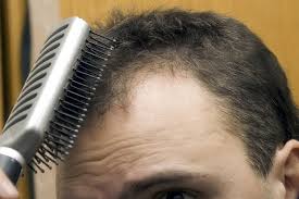 All of these together help hair to grow faster; Thinning Hair Australian Emu Oil Has An Amazing Effect On Hair Growth