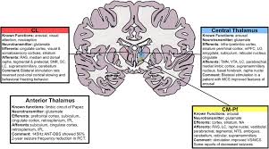 Image result for Thalamic Stimulation