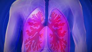It's important for your doctor to determine the site of the bleeding, and then determine why you're coughing up blood. Man Coughing Blood Clots In The Shape Of A Lung Tree Doctors Astonished