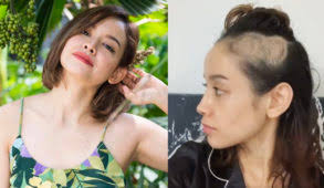 What Happened to Bea Benedicto?