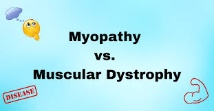 Image result for Myopathy