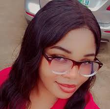 This is the beautiful Amara Aleman, a former dancer turned artist, she  turns her vitiligo into stunning body art, lovingly referring to her  creations as “ArtSpots.” #explore #explorepage