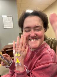 Hello, I'm Sandra and something to know about me is that I'm in the UK! I  was diagnosed last year with CKD4, then discovered after an ultrasound and  MRI scans that I've