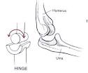 Hinge joint definition of hinge joint by Medical dictionary