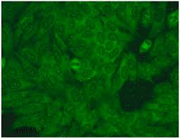 Image result for ANA Staining Pattern