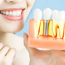 We provide free dental care consultation. Smile Dental The Dentists Auckland Affordable Dental Care Clinic