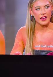 Holy hives. Ben’s a problem #loveisblind #loveisblindnetflix #fyp