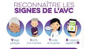 Quels sont les facteurs de notez l'heure de survenue des premiers signes de l'avc. Avc Les Gestes Pour Le Prevenir Et Les Signes Pour Le Reperer Bio A La Une