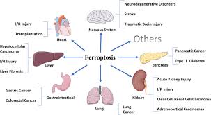 If even the slightest signs of digestive dysfunction (epigastric pain, nausea, etc. Ferroptosis Past Present And Future Cell Death Disease