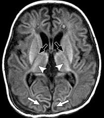 Image result for Hypoxis nyasica