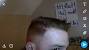 Early Stage Signs Of Balding At 20