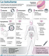 What are the most common causes of botulism? Botulisme Des Preparations Alimentaires En Causes Sciences Et Avenir