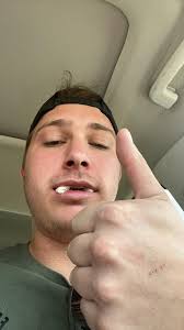 What are some recommended drinks for a liquid diet after wisdom teeth  removal?