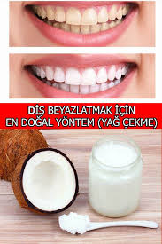 Evde Dis Beyazlatma Nasil Yapilir Tamamen Dogal Yontem Evde Nasil Yapilir Dogal Dis Beyazlatma Dis Dogal