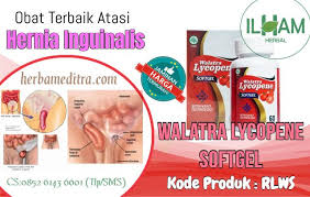 Obat Tradisional Hernia Inguinalis Tanpa Operasi Operasi