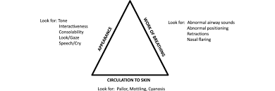 Image result for Pediatric Assessment Triangle