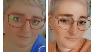 Fundraiser by Stephanie Budde : Jetzt fehlt nur noch die Hautstraffung…