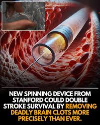 Ultrasonic “tornado”: a new faster way to break down blood clots.  Researchers have developed a groundbreaking method using "vortex ultrasound,"  which acts like an ultrasonic tornado, to break down dangerous blood clots