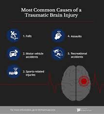 Image result for Brain Contusion