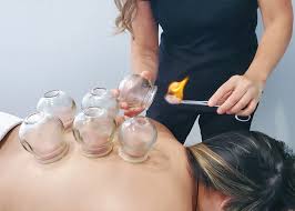 Dietetics in traditional chinese medicine (tcm) compleme. Why Is The Chinese Cupping Therapy Becoming So Popular Know Latest Breaking News Celebrity News And Gossip Stackumbrella