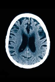 Image result for Medical Cognitive Error