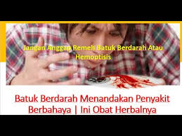Kendati begitu, anda tidak boleh mengabaikan batuk berdarah. Batuk Berdarah Menandakan Penyakit Berbahaya Ini Obat Herbalnya Youtube