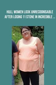 Pin On A Stone Weight Loss Before And After