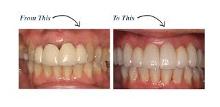 Affordable Dentist Houston Tx Affordable Dental Near Me In 2020 Affordable Dentist Affordable Dental Care Affordable Dental