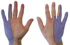 Cubital Tunnel Syndrome Hand Orthobullets