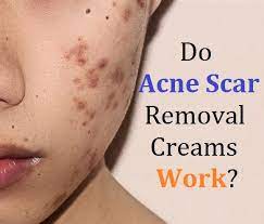 Pin On Skin Care