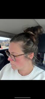 Hair products for lupus patients?