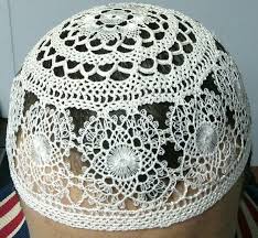 Toptan Takke Alabiliriz Dantel Gupur Igne Oyasi Takke Yapan Ablalar Varsa Mesaj Gonderirse Sevinirim Tig Isleri Dantel Oya