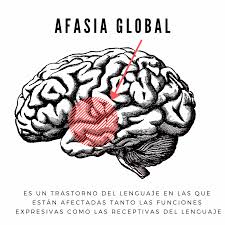 Global aphasia is a severe form of nonfluent aphasia, caused by damage to the left side of the brain, that affects receptive and expressive language skills (needed for both written and oral language) as well as auditory and visual comprehension. Pin On Motivaciones Medicas