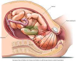 Anterior Placenta Labor And Delivery Fetus In 2 Station In Anterior Presentation Newborn Nursing Midwifery Medical Knowledge