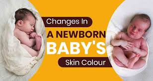 Maybe you would like to learn more about one of these? Why A Baby S Skin Colour Changes 7 Common Reasons