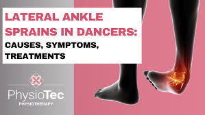 Image result for Dancer Injuries