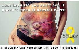 Endometriosis is estimated to affect as many as one in 10 women worldwide. 10 Brilliant Quotes About Endometriosis Bubbles In The Brain