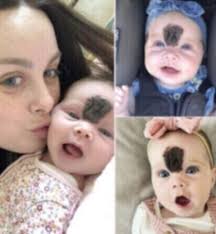 18:05:10 This baby girl was trolled for her looks — now at 2 years old, she  is 'gorgeous' after her parents' made a brave decision. Check out little  Vienna's stunning new look