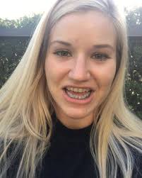 Episiotomy...an old practice. Episiotomy is a cut made to a woman’s  perineum during a vaginal delivery. Old school thinking...episiotomy=clean  cut, faster healing, faster delivery. New evidence shows ...