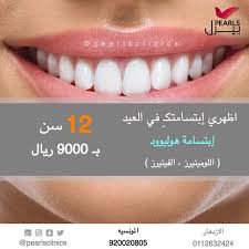 اظهري إبتسامتكـ في العيد إبتسامة هوليوود الحين 12 سن 9000 ريال مجمع عيادات بيرل My Photos Photo Pearls